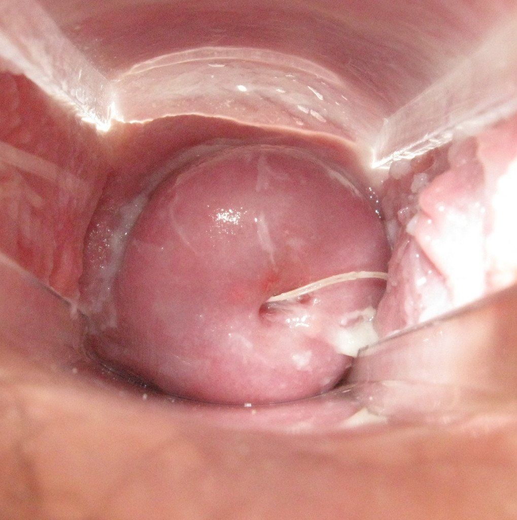 best of Cunt fertile sperm thrusting cervix