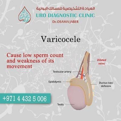 best of Count verices scrotum sperm