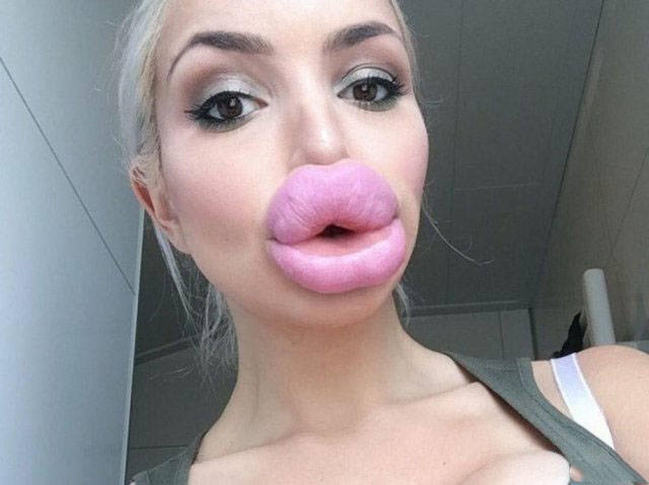 Fucking plastic lips
